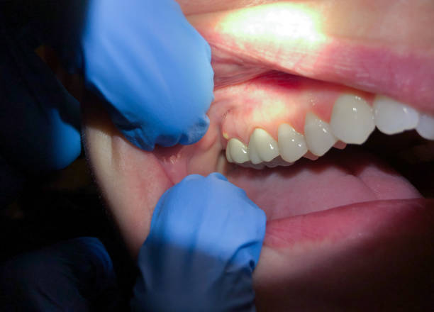Best Weekend Emergency Dentist in Woxall, PA